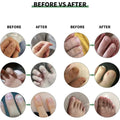 NAILS SERUM FOR NAIL GROWTH & REPAIR, FUNGAL INFECTION, ANTI-INFECTIVE REMOVAL PARONYCHIA ONYCHOMYCOSIS