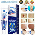 Wart Remover Ice Cream Mask